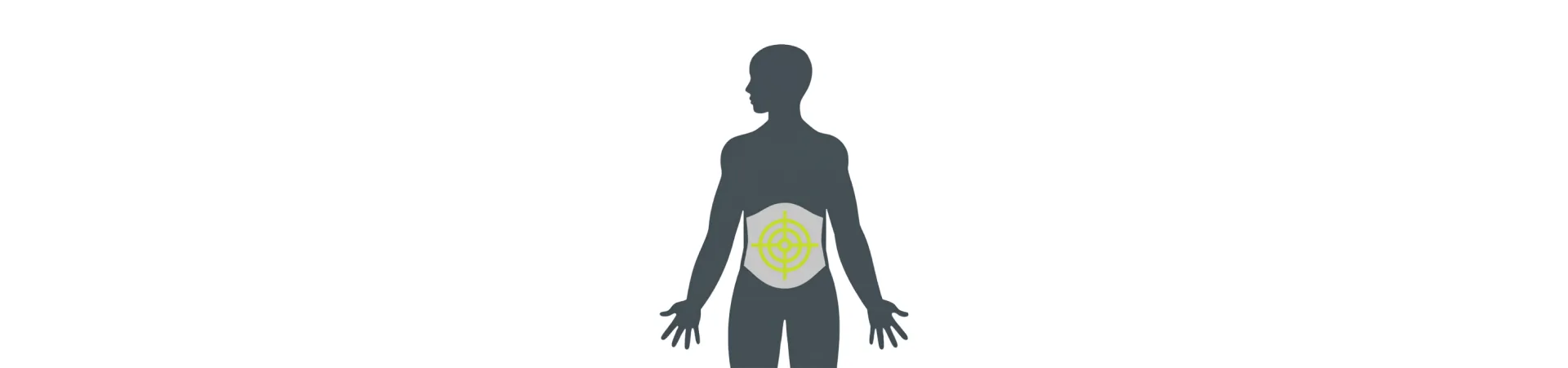 Illustration of a local injection into the abdominal cavity